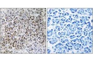 Immunohistochemistry analysis of paraffin-embedded human pancreas tissue, using MRPL40 Antibody. (MRPL40 anticorps  (AA 101-150))