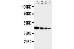 Lane 4: Recombinant Human TICAM1 Protein 1.