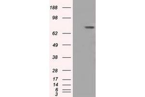 Western Blotting (WB) image for anti-Bruton Agammaglobulinemia tyrosine Kinase (BTK) antibody (ABIN1496975) (BTK anticorps)