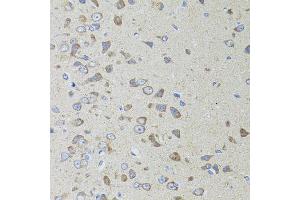 Immunohistochemistry of paraffin-embedded rat brain using AIFM3 antibody (ABIN5996156) at dilution of 1/100 (40x lens). (AIFM3 anticorps)