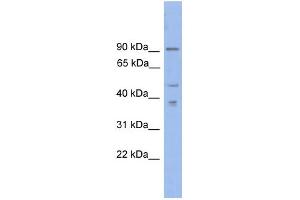 WB Suggested Anti-ZFX Antibody Titration:  0. (ZFX anticorps  (N-Term))