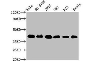 Western Blot Positive WB detected in: Hela whole cell lysate, SH-SY5Y whole cell lysate, 293T whole cell lysate, U87 whole cell lysate, PC-3 whole cell lysate, Rat brain tissue All lanes: KTI12 antibody at 3. (KTI12 anticorps  (AA 110-204))