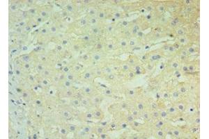 Immunohistochemistry of paraffin-embedded human liver tissue using ABIN7145678 at dilution of 1:100 (BST2 anticorps  (AA 49-161))