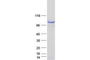Validation with Western Blot