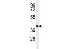 CCR8 antibody western blot analysis in MDA-MB435 lysate (CCR8 anticorps  (AA 290-317))