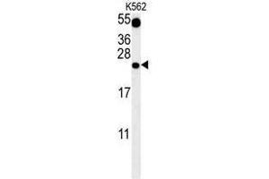 TFAM Antibody (C-term) western blot analysis in K562 cell line lysates (35 µg/lane). (TFAM anticorps  (C-Term))