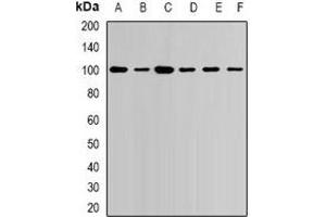 Western blot analysis of USP16 expression in Jurkat (A), NIH3T3 (B), COS7 (C), mouse heart (D), mouse spleen (E), rat brain (F) whole cell lysates. (USP16 anticorps)