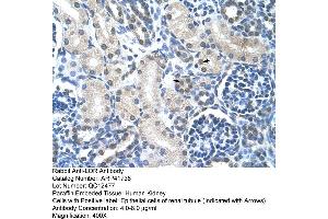 Rabbit Anti-LOR Antibody  Paraffin Embedded Tissue: Human Kidney Cellular Data: Epithelial cells of renal tubule Antibody Concentration: 4. (LOR anticorps  (N-Term))