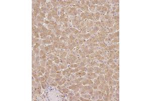 Immunohistochemical analysis of C on paraffin-embedded Human liver tissue.