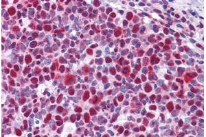 Human Tonsil: Formalin-Fixed, Paraffin-Embedded (FFPE)