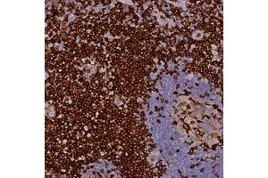 Immunohistochemical staining of human tonsil with FYB polyclonal antibody ( Cat # PAB28030 ) shows strong cytoplasmic positivity at 1:50 - 1:200 dilution. (FYB anticorps)