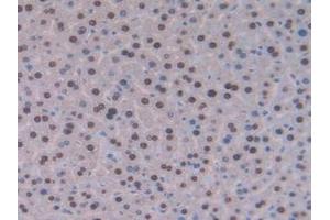IHC-P analysis of Mouse Liver Tissue, with DAB staining. (GCKR anticorps  (AA 17-261))