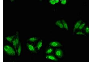 Immunofluorescent analysis of HepG2 cells using ABIN7160314 at dilution of 1:100 and Alexa Fluor 488-congugated AffiniPure Goat Anti-Rabbit IgG(H+L)
