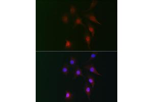 Immunofluorescence analysis of NIH-3T3 cells using FB2 Rabbit pAb (ABIN7267112) at dilution of 1:100 (40x lens).