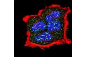 Confocal immunofluorescent analysis of phospho-TSC2 antibody with MCF-7 cells followed by Alexa Fluor 488-conjugated goat anti-rabbit lgG (green).