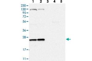 Western blot analysis of Lane 1: RT-4, Lane 2: U-251 MG, Lane 3: Human Plasma, Lane 4: Liver, Lane 5: Tonsil with ARL4C polyclonal antibody  at 1:250-1:500 dilution. (ARL4C anticorps)
