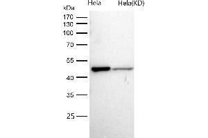 All lanes use the Antibody at 1:1K dilution for 1 hour at room temperature.