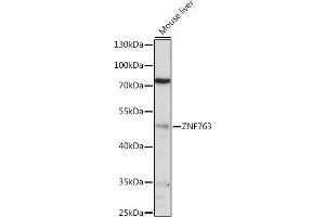 anti-Zinc Finger Protein 763 (ZNF763) (AA 315-370) antibody