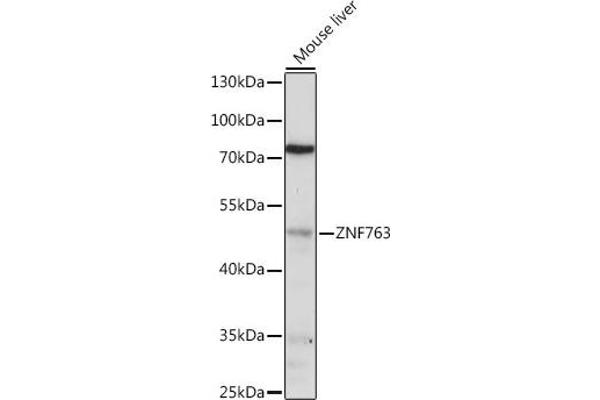 ZNF763 anticorps  (AA 315-370)