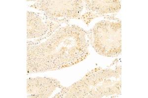 Immunohistochemistry of paraffin embedded mouse testis using RAPGEF5 (ABIN7075365) at dilution of 1:700 (400x lens)