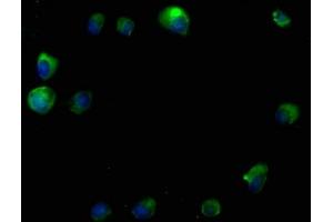 Immunofluorescence staining of MCF-7 cells with ABIN7140114 at 1:50, counter-stained with DAPI. (RTN4RL2 anticorps  (AA 355-372))