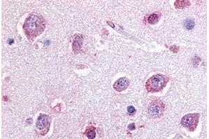Human Brain, Cortex (formalin-fixed, paraffin-embedded) stained with P2RY8 antibody ABIN213464 at 20 ug/ml followed by biotinylated goat anti-rabbit IgG secondary antibody ABIN481713, alkaline phosphatase-streptavidin and chromogen.