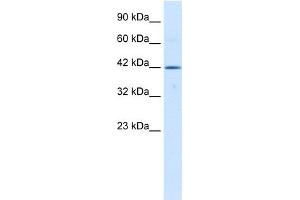 WB Suggested Anti-TBX6 Antibody Titration:  0. (T-Box 6 anticorps  (Middle Region))