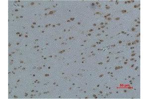 Immunohistochemical analysis of paraffin-embedded Rat Brain Tissue using L-type Ca++ CP γ4 Polyclonal Antibody.