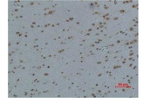 Immunohistochemical analysis of paraffin-embedded Rat Brain Tissue using L-type Ca++ CP γ4 Polyclonal Antibody. (CACNG4 anticorps)