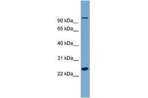 WB Suggested Anti-SEMA3D Antibody Titration: 0. (SEMA3D anticorps  (Middle Region))