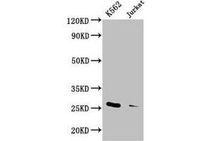 Western Blot Positive WB detected in: K562 whole cell lysate, Jurkat whole cell lysate All lanes: MOB1A antibody at 3. (MOB1A anticorps  (AA 2-216))