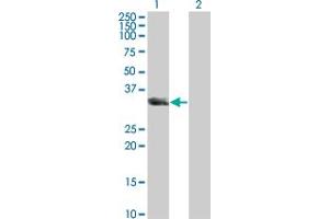 Western Blot analysis of UNC119 expression in transfected 293T cell line by UNC119 monoclonal antibody (M01A), clone 2F9-2A9. (UNC119 anticorps  (AA 1-240))