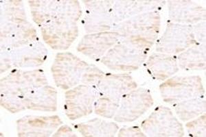 Immunohistochemistry analysis of paraffin-embedded mouse skeletal muscle using TBX10 (ABIN7075814) at dilution of 1: 4600