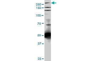 TLN1 monoclonal antibody (M05), clone 5C1. (TLN1 anticorps  (AA 1052-1149))
