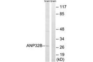 Western blot analysis of extracts from rat brain cells, using ANP32B Antibody. (ANP32B anticorps  (AA 1-50))
