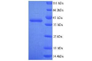 SDS-PAGE (SDS) image for Talin 2 (TLN2) (AA 88-406) protein (His tag) (ABIN5714530)