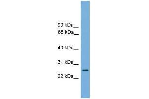 WB Suggested Anti-RAB35 Antibody Titration: 0. (RAB35 anticorps  (Middle Region))