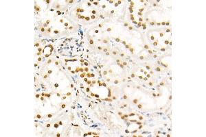 Immunohistochemistry of paraffin-embedded rat ovary using H4K8ac antibody (ABIN7267747) at dilution of 1:100 (40x lens).
