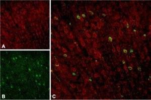 Expression of Sortilin in rat neocortex - Immunohistochemical staining of rat neocortex with Anti-Sortilin (extracellular) Antibody (ABIN7043768, ABIN7044759 and ABIN7044760).