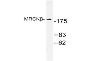 Western blot (WB) analysis of MRCKβ antibody in extracts from COLO cell. (CDC42BPB anticorps)