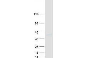Validation with Western Blot
