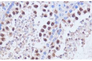 Immunohistochemistry of paraffin-embedded Mouse testis using BRD4 Polyclonal Antibody at dilution of 1:100 (40x lens). (BRD4 anticorps)