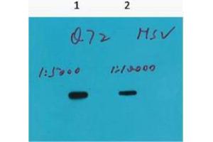 Western Blotting (WB) image for anti-HSV Tag antibody (ABIN3181183) (HSV Tag anticorps)