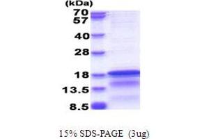 Hepatitis C Virus Core Protein (HCV C) (AA 1-120) protein (His tag)