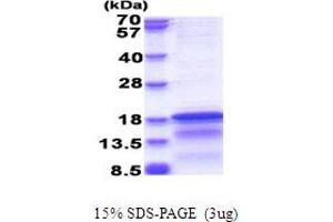 SDS-PAGE (SDS) image for Hepatitis C Virus Core Protein (HCV C) (AA 1-120) protein (His tag) (ABIN5853816) (HCV Core Protein Protein (AA 1-120) (His tag))