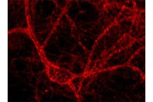 anti-Amphiphysin (AMPH) (AA 2-15) antibody