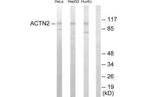 Western blot analysis of extracts from HeLa cells, HepG2 cells and HUVEC cells, using Actin α-2/3 antibody.