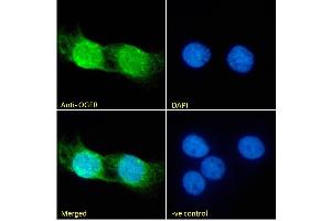 (ABIN185551) Immunofluorescence analysis of paraformaldehyde fixed A431 cells, permeabilized with 0. (OGFR anticorps  (C-Term))