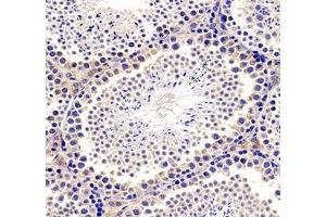 Immunohistochemistry analysis of paraffin-embedded mouse brain using TESK1 (ABIN7075866) at dilution of 1: 500