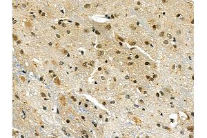 ABIN6260045 and ABIN6276424 at 1/100 staining Rat brain tissue by IHC-P.